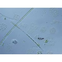 Aphanocapsa