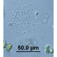 Aphanocapsa 