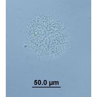Aphanocapsa
