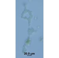 Aphanocapsa stagnalis