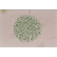 Aphanocapsa elegans