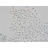Aphanocapsa muscicola