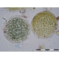 Aterocapsa cf. belizensis