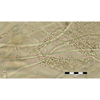 Bacularia gracilis