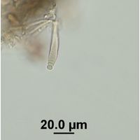 Chamaesiphon cenfervicola