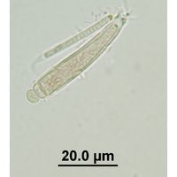 Chamaesiphon cenfervicola