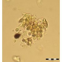 Chamaesiphon starmachii