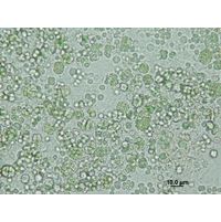 Chroococcidiopsis thermalis