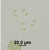 Chroococcus limneticus