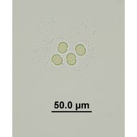 Chroococcus limneticus