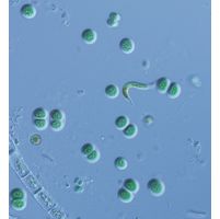 Chroococcus obliteratus