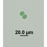 Chroococcus turgidus