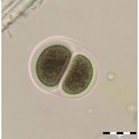 Chroococcus turgidus