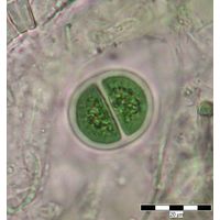 Chroococcus turgidus