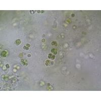 Cyanosarcina
