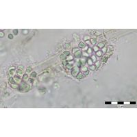 Cyanosarcina