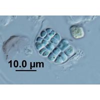 Cyanosarcina thalassia