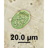 Cyanothece aeruginosa