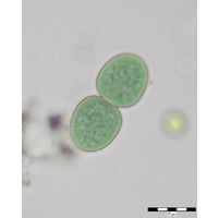 Cyanothece aeruginosa
