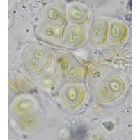 Gloeocapsa rupestris