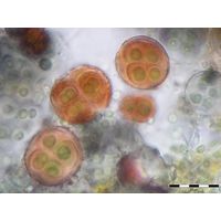 Gloeocapsa novacekii