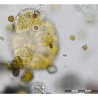 Gloeocapsa biformis