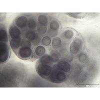 Gloeocapsa alpina