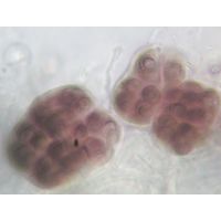 Gloeocapsa compacta