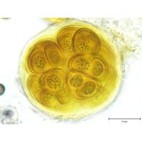 Gloeocapsa rupestris