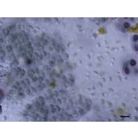Gloeocapsa atrata