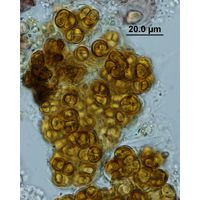 Gloeocapsopsis cf. crepidum
