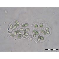 Gloeothece interspersa
