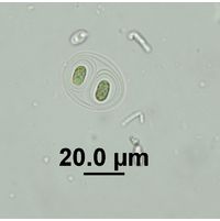 Gloeothce tepidariorum