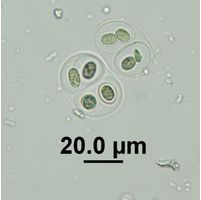 Gloeothce tepidariorum