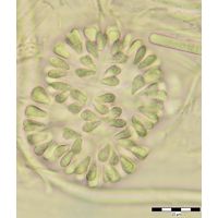 Gomphosphaeria semen-vitis