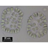 Gomphosphaeria semen-vitis