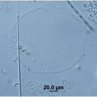 Lemmermanniella parva