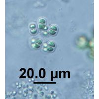 Limnococcus limneticus