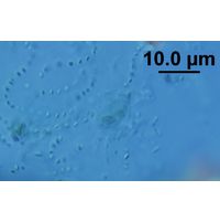 Lithococcus ramosus