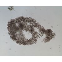 Microcystis aeruginosa