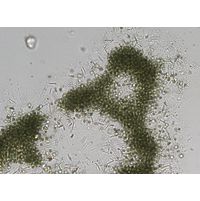 Microcystis aeruginosa