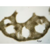 Microcystis aeruginosa