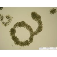 Microcystis aeruginosa
