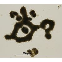 Microcystis aeruginosa
