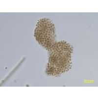 Microcystis ichthyoblabe