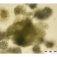 Microcystis ichthyoblabe