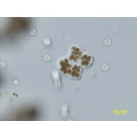 Microcystis viridis