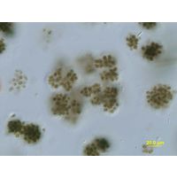 Microcystis viridis