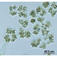Microcystis viridis