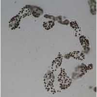 Microcystis wesenbergii